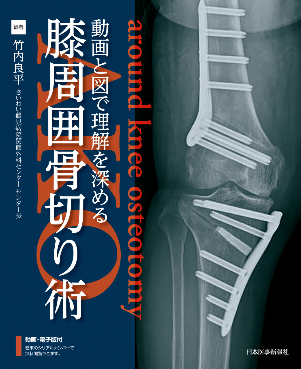 第49回日本骨折治療学会学術集会 おすすめ書籍｜Web医事新報|日本医事 