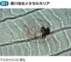 横川吸虫症 有害異形吸虫症を含む 電子コンテンツ 日本医事新報社