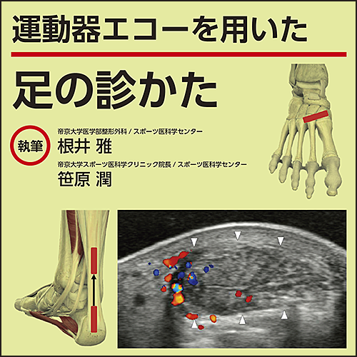 運動器エコーを用いた 足の診かた｜電子コンテンツ|日本医事新報社